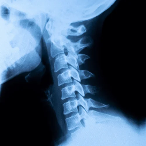 2nd Chiropractic Visit